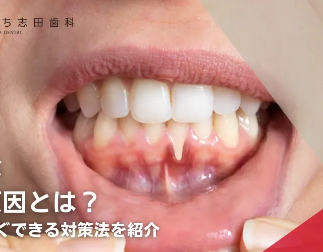 歯茎が黒い原因とは？見た目だけじゃないリスクと対策
