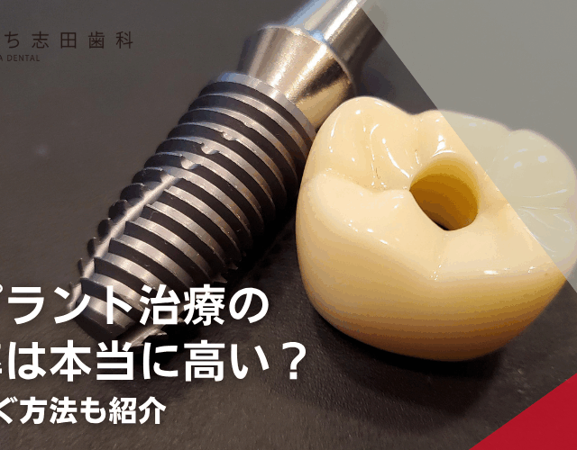 インプラント治療の成功率は本当に高い？失敗を防ぐ方法も紹介