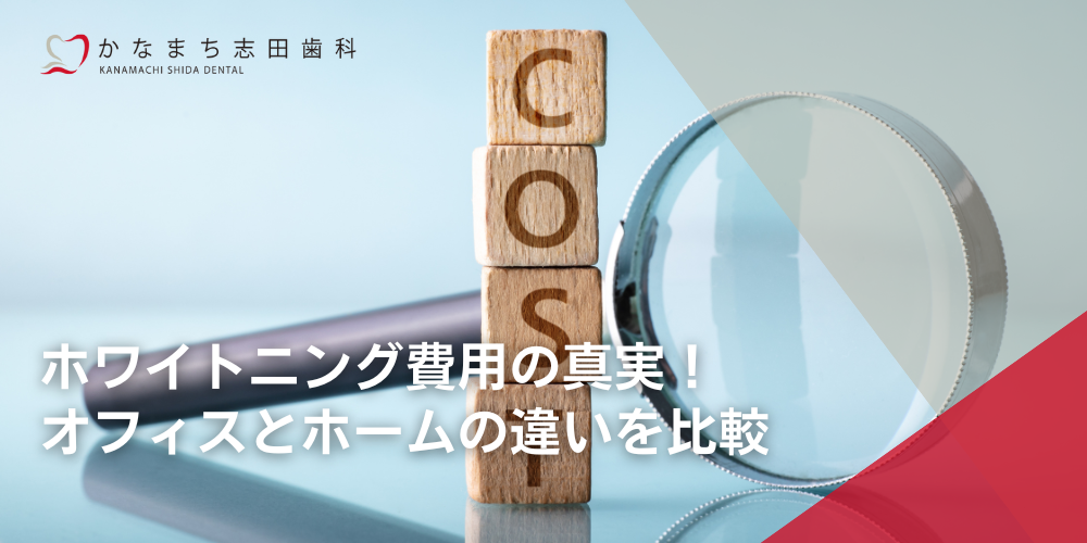 ホワイトニング費用の真実！オフィスとホームの違いを比較