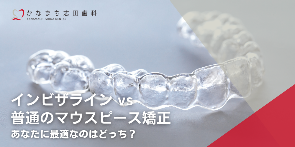 【比較解説】インビザラインvs普通のマウスピース矯正：あなたに最適なのはどっち？