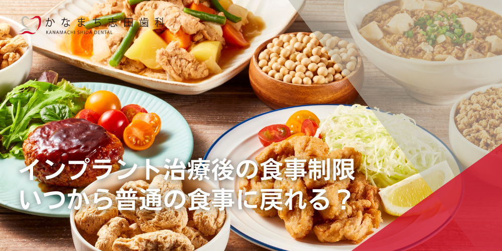 インプラント治療後の食事制限：いつから普通の食事に戻れる？