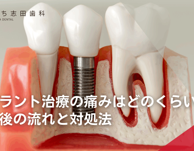 インプラント治療の痛みはどのくらい？治療前後の流れと対処法