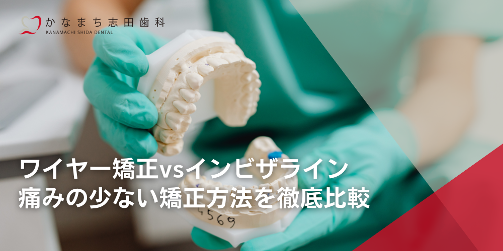 ワイヤー矯正vsインビザライン:痛みの少ない矯正方法を徹底比較