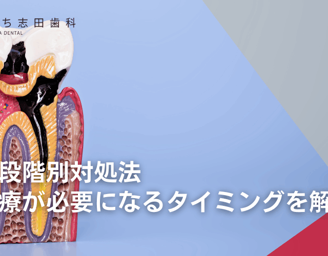 虫歯の段階別対処法：神経治療が必要になるタイミングを解説