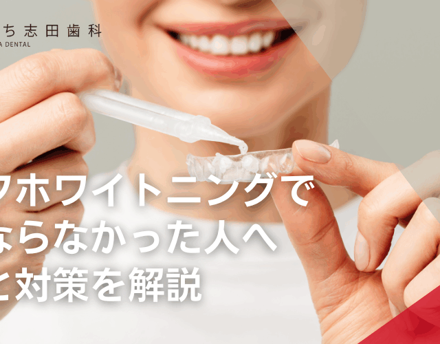 セルフホワイトニングで白くならなかった人へ。原因と対策を解説