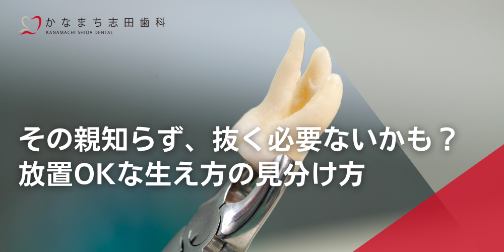 その親知らず、抜く必要ないかも？放置OKな生え方の見分け方
