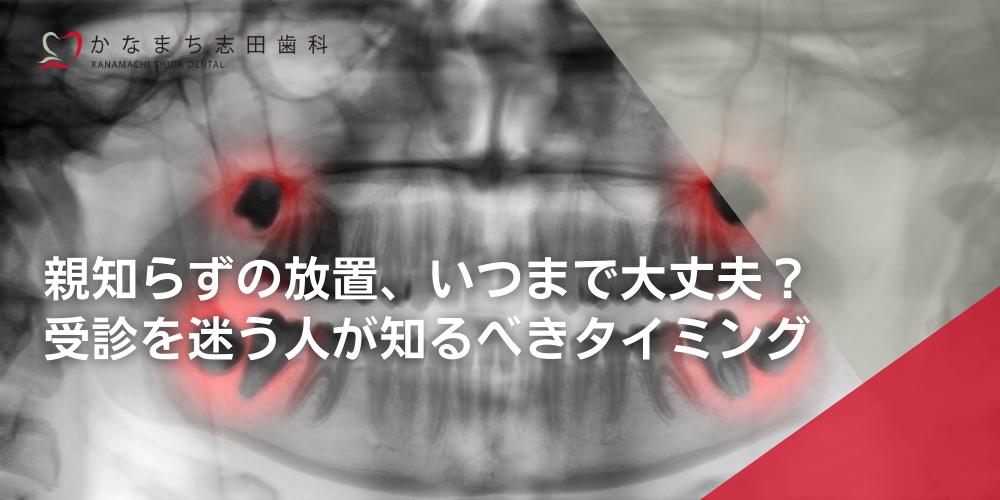 親知らずの放置、いつまで大丈夫？受診を迷う人が知るべきタイミング