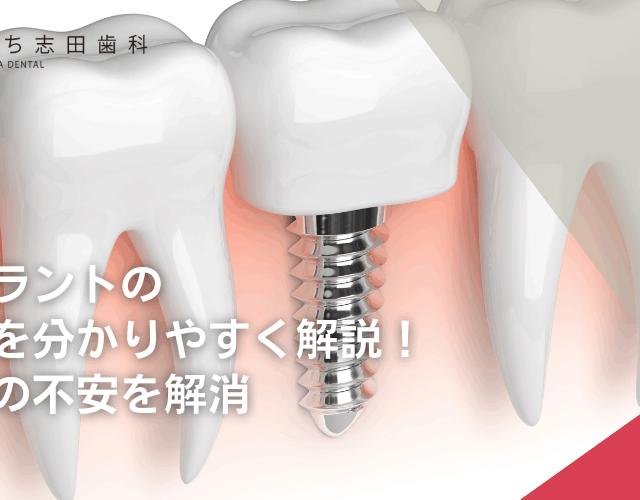 インプラントの成功率を分かりやすく解説！手術前の不安を解消