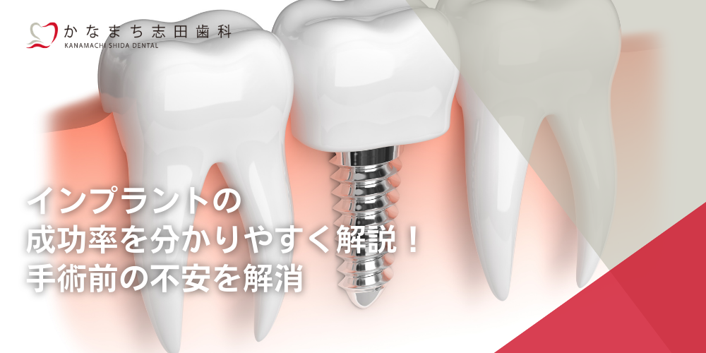 インプラントの成功率を分かりやすく解説！手術前の不安を解消