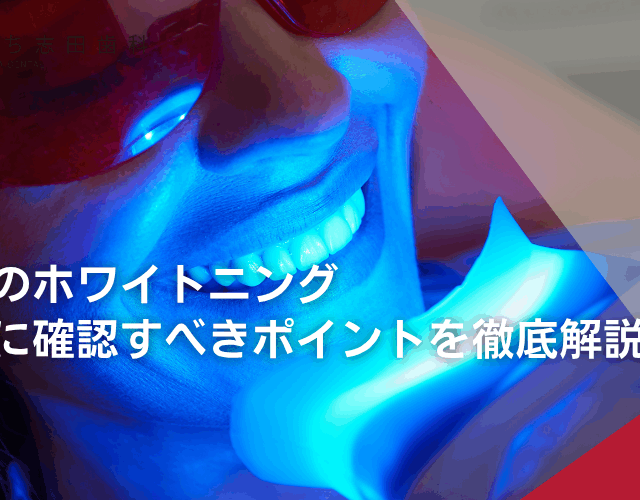 初めてのホワイトニング｜施術前に確認すべきポイントを徹底解説