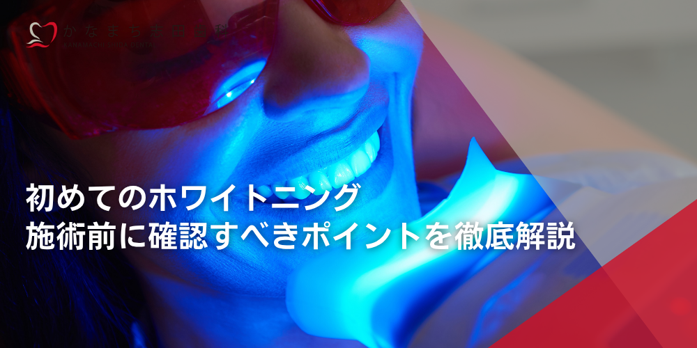 初めてのホワイトニング｜施術前に確認すべきポイントを徹底解説