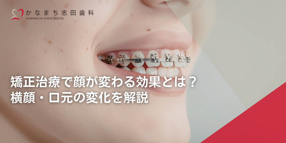 矯正治療で顔が変わる効果とは？横顔・口元の変化を解説