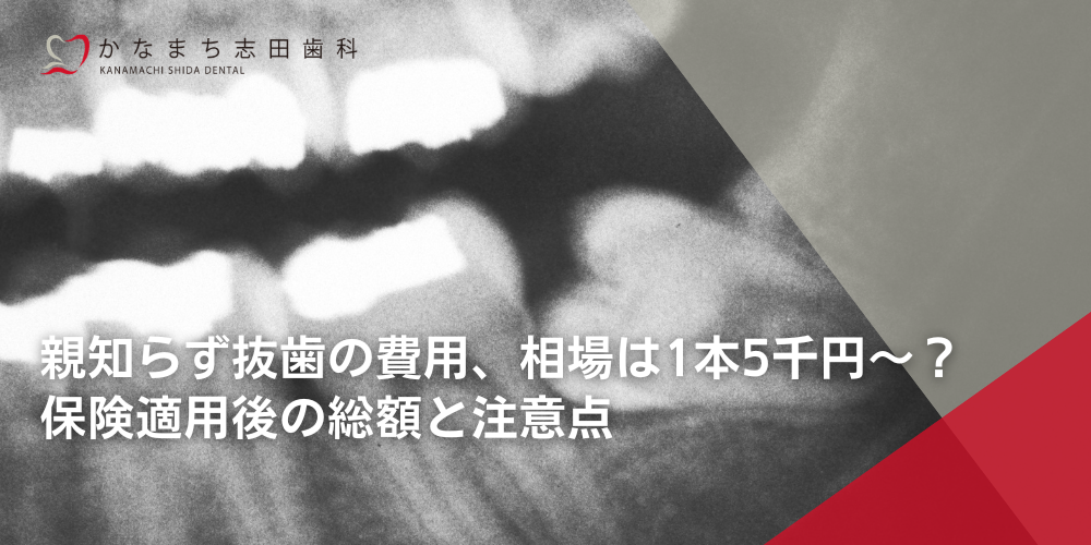 親知らず抜歯の費用、相場は1本5千円～？保険適用後の総額と注意点