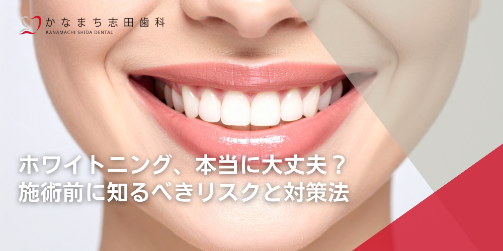 ホワイトニング、本当に大丈夫？施術前に知るべきリスクと対策法