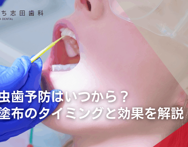 子供の虫歯予防はいつから？フッ素塗布のタイミングと効果を解説