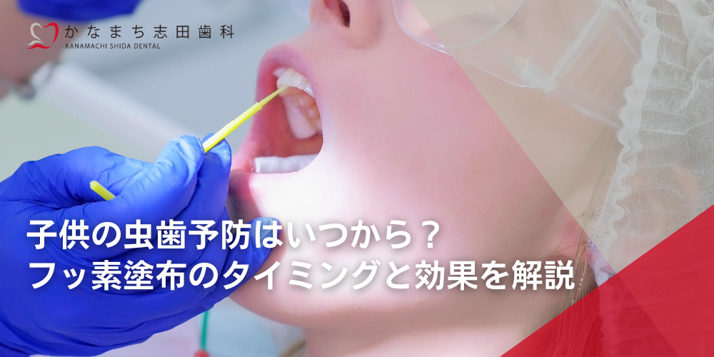 子供の虫歯予防はいつから?フッ素塗布のタイミングと効果を解説
