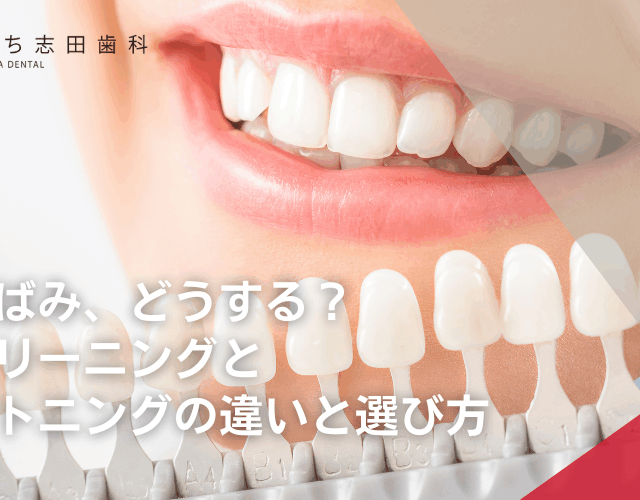 その黄ばみ、どうする？歯のクリーニングとホワイトニングの違いと選び方