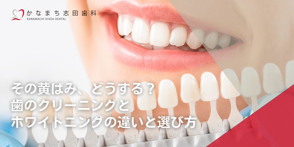 その黄ばみ、どうする?歯のクリーニングとホワイトニングの違いと選び方