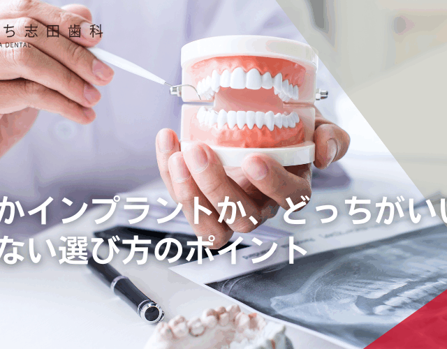 入れ歯かインプラントか、どっちがいい？後悔しない選び方のポイント