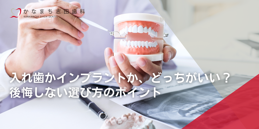入れ歯かインプラントか、どっちがいい?後悔しない選び方のポイント