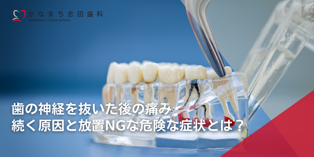 歯の神経を抜いた後の痛み|続く原因と放置NGな危険な症状とは?