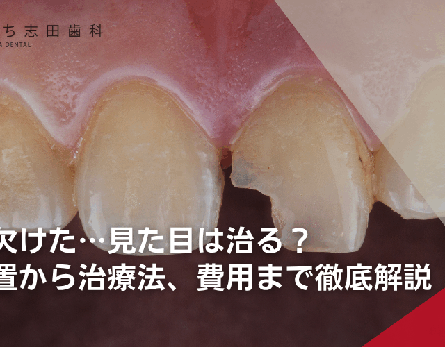 前歯が欠けた…見た目は治る？応急処置から治療法、費用まで徹底解説