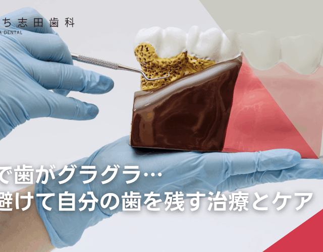 歯周病で歯がグラグラ…抜歯を避けて自分の歯を残す治療とケア