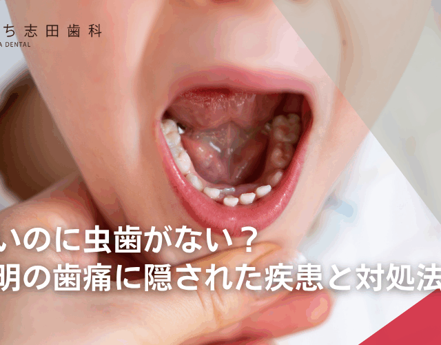 歯が痛いのに虫歯がない？原因不明の歯痛に隠された疾患と対処法