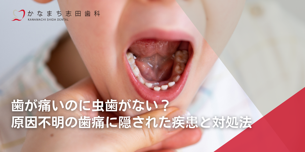 歯が痛いのに虫歯がない？原因不明の歯痛に隠された疾患と対処法